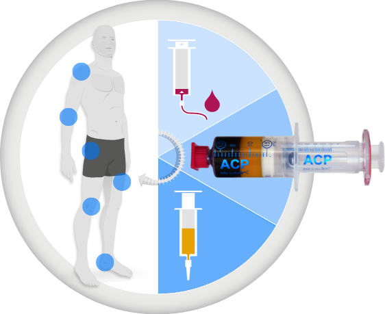 Acp therapie
